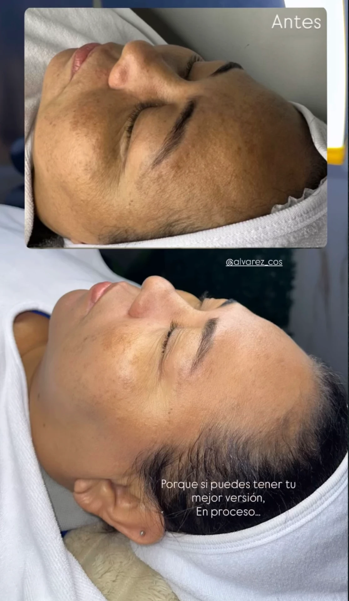Antes y después: Acompañamiento para manchas